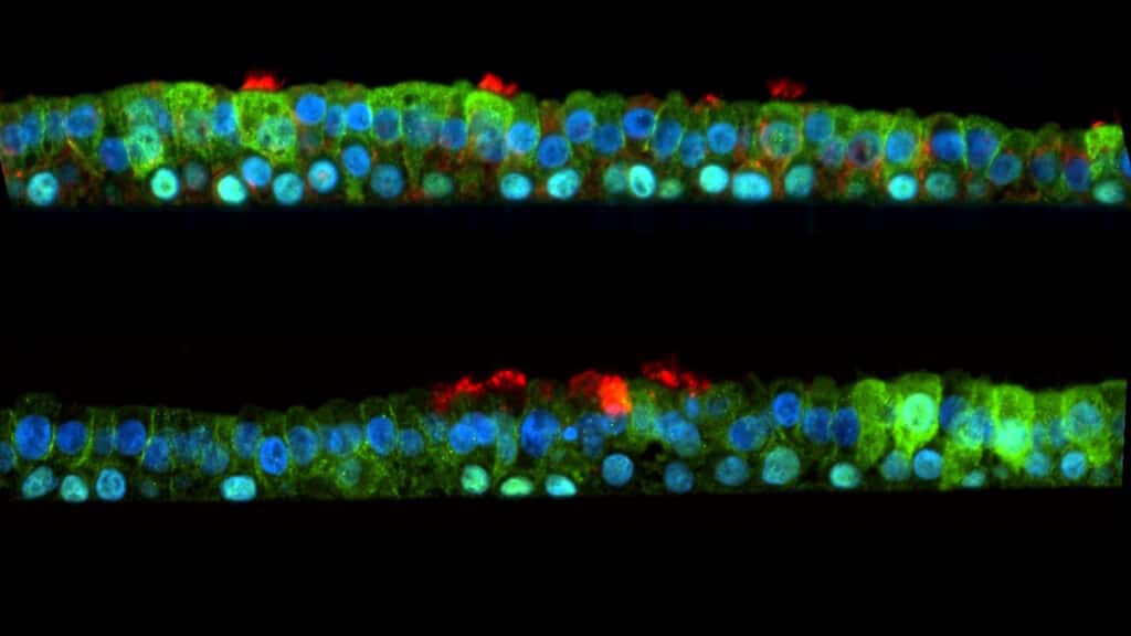 Research shows nasal spray that protects against COVID-19 is also effective against the common cold