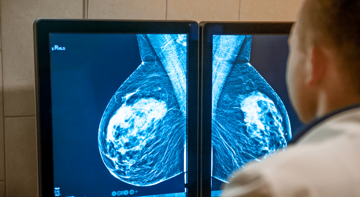 Mammogram scan